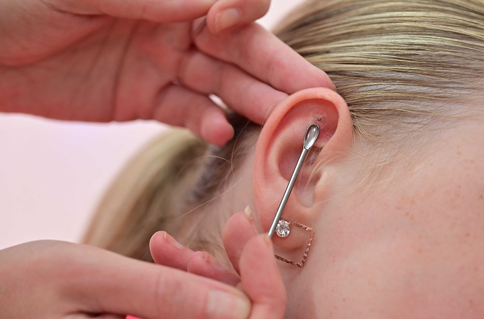 The tiny metal seeds are placed on acupressure points on the ears for up to five days and can relieve stress and anxiety.